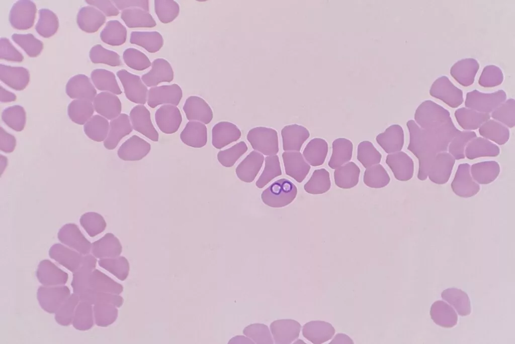 În această imagine microscopică a globulelor roșii pot fi recunoscute două babesii ca structuri mov.
