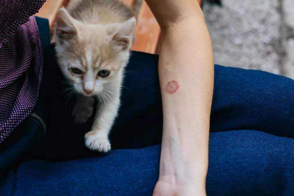 Persoană care a contractat o ciupercă de piele de la pisică. Pată rotundă rosiatica pe bratul unei persoane care sta cu un pui de pisica in brate