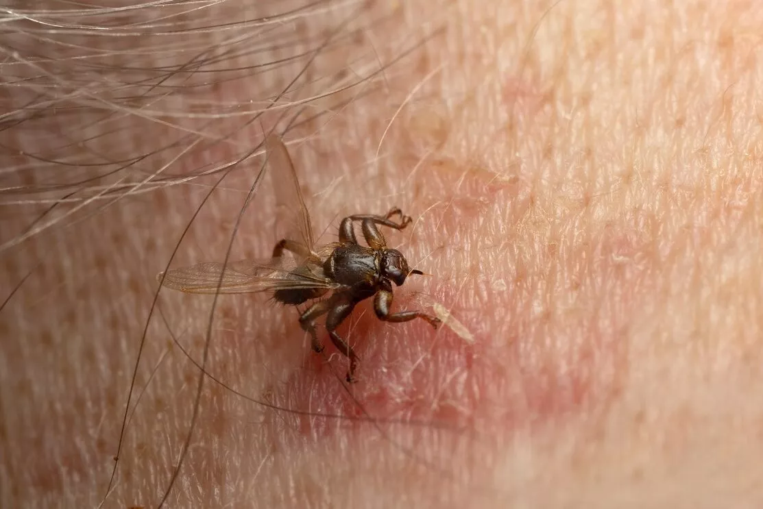 Musca cerbului, Lipoptena cervi, pe pielea unui om. Lângă ea este o muscătură roșie